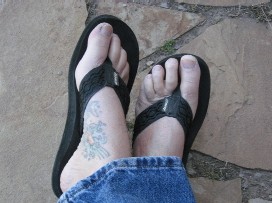 Flip Flop Feet Get Callus Cracks Flip Flop Feet Get Callus Cracks